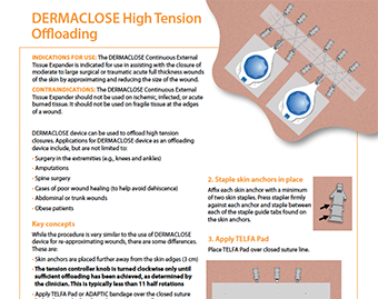 ERMACLOSE High Tension Offloading